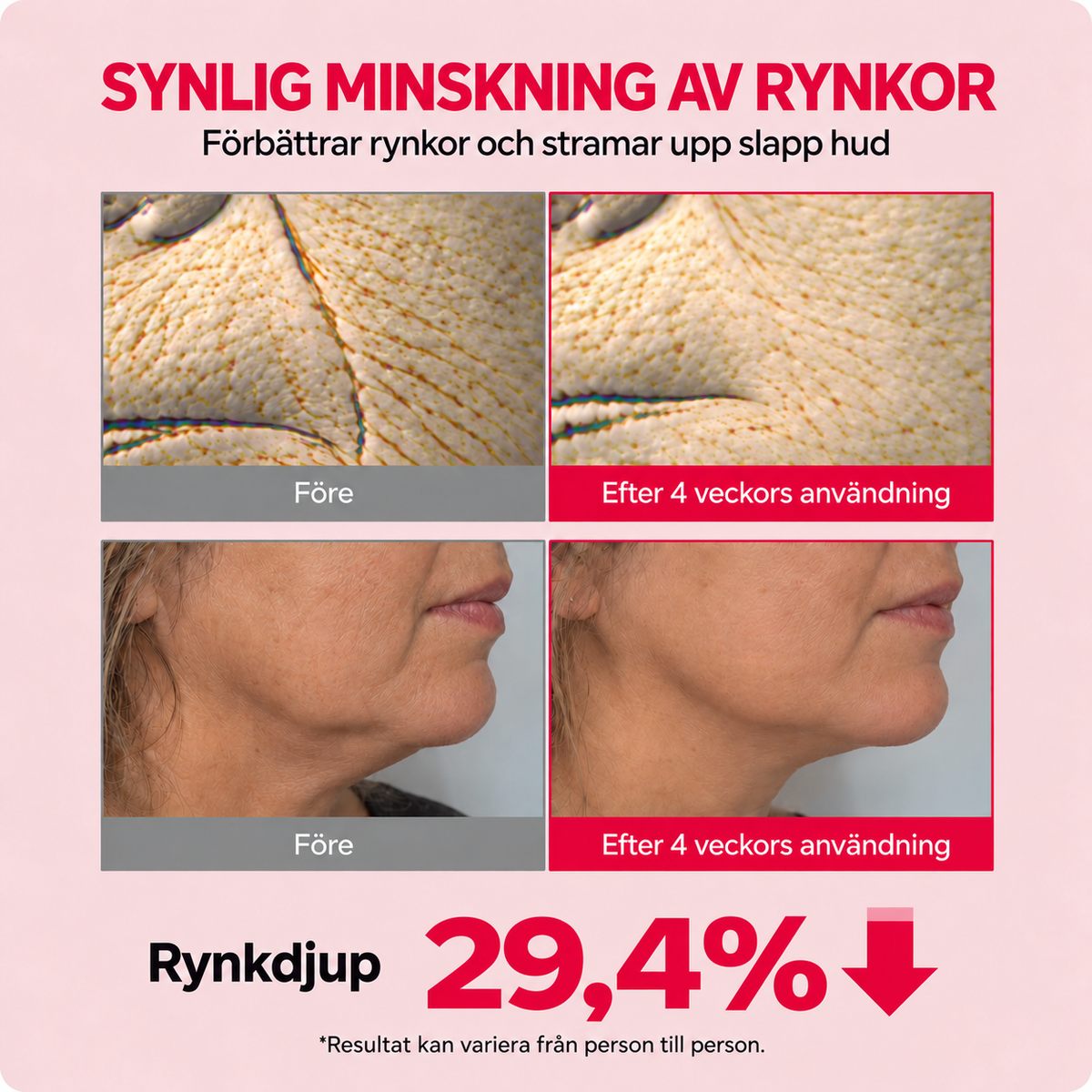 Före- och efterbild med texten Rynkdjup 29,4 procent